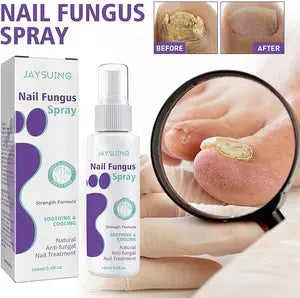 Nail Fungus Spray | Persistent Nail Fungus Issues NOURIVUE