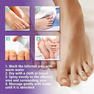 Nail Fungus Spray | Persistent Nail Fungus Issues NOURIVUE