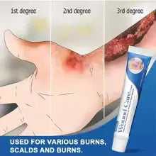 Sumifun - Wound Care Antiseptic Cream | Infected Minor Wounds NOURIVUE